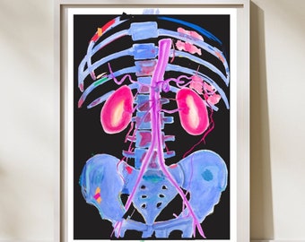 Radiology Anatomy Art, Abdominal CTA, Radiology Gifts, Kidney Art, Vascular Sonographer, Vascular Surgery, Abdominal Anatomy Artwork