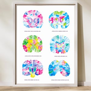 Brain Art, Brain Anatomy, Neuroscience Gift, Nervous System, Neurology Art, Neurologist Gift, Neurology Print, Neuroscience Art