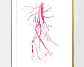Angiography Femoral Spf Artery Occlusion Anatomy Art Print, Interventional Radiology Art, Angiology Art, Radiology Tech Gift
