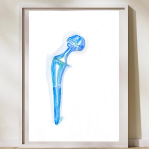 Hip Prosthesis Art, Hip Replacement Surgery, Artificial Joint, Orthopedic Surgeon Gift, Physical Therapy Art, Bioengineer Gift