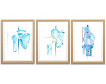 Orthopedic Surgeon Gift, Arthroplasty Art, Physical Therapist Gift,  Physical Therapy Wall Art