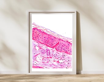 Sun Damaged Skin Histology Art - Photoaging - Dermatology Office Wall Decor, Actinic Elastosis, Plastic and Cosmetic Surgery
