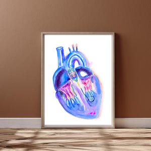 Transaortic Valve Replacement, Cardiology Art, Interventional Cardiologist Gift, Cardiac Surgeon Doctor Nurse Gift, Heart Anatomy, Tav