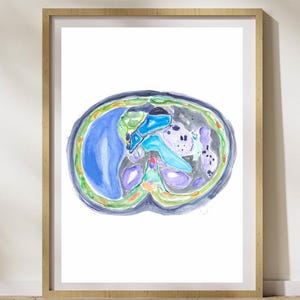 Radiology Artwork, CT Radiology, Abdominal Anatomy, Radiology Print, Gastrointestinal Art, Gastroenterology Doctor, Abdomen Cross Section