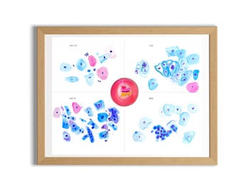 Cervix Cytology, Abnormal Pap Smear, Pathology Art, Histopathology Art, Gynecology Art, OBGYN Wall Art
