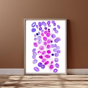 Mastozytose - Mastzellkrankheiten Histopathologie Kunst, Hämatologen Geschenk,Immunologie Kunstdruck, Knochenmark