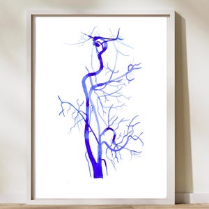Carotid Angiography,  Radiology Art, Neurology Art, Neurosurgery Art, Vascular Surgery, Angio Tech Gift, Vascular Anatomy, CT Art