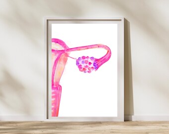 PCOS - Polyendocrine Metabolic Ovarian Syndrome PMOS -  Abstract Uterus Anatomy Art Print