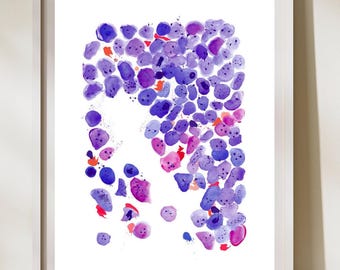 Acute Myeloid Leukemia Art Print, Hematology Art, Hematologist Office Art, Hematologist Gift, Pathologist Gift, Laboratory Artwork, AML