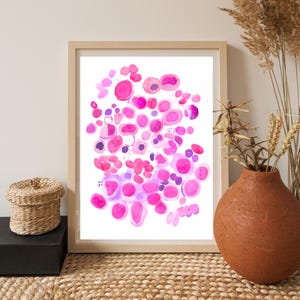 Erythroid Hyperplasia - Megaloblastic Anemia, Hematology and Pathology Art Print, Hematologist Gift, Pathologist Assistant Gift