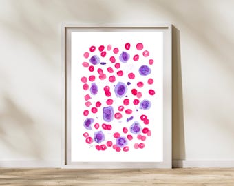 Veterinary Pathology - Dog Chronic Lymphocytic Leukemia - CLL - Veterinarian Gift, Veterinary Clinic Decor