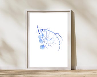 Coronary Angiogram -  Percutaneous Coronary Intervention