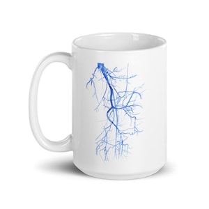 Radiologimugg, present till kärlkirurgi, radiologmugg, kärlsjuksköterska med sonografmugg, present till kärlkirurgistipendium, medicinmugg