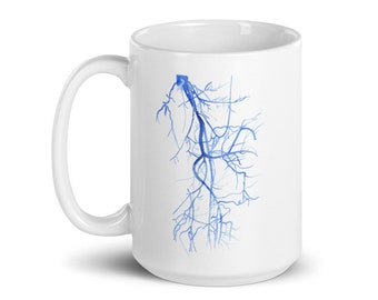 Mug radiologie, cadeau chirurgie vasculaire, mug radiologue, mug infirmière échographiste vasculaire, cadeau bourse de recherche en chirurgie vasculaire, mug médecine