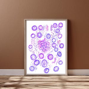 Crohn&#39;s Disease, Pathology Art, Histology Artwork, Pathologist Gift, Pathology Wall Decor, Histology Gifts, Pathology Gifts
