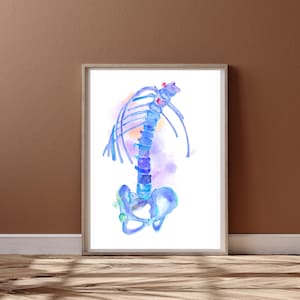 Bechterew - Ankylosing Spondylitis, Rheumatology Art Gifts, Pain Medicine Gifts, Physical Therapy Wall Art, Physical Medicine Rehabilitation