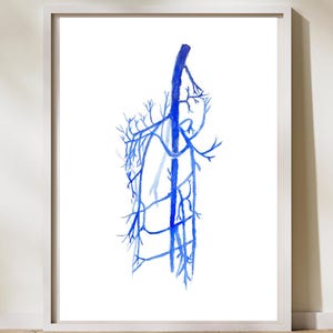 External Iliac, Femoral, Saphenous Vein Anatomy, Lower Limb Anatomy, Venography, Phlebography, Vascular Surgery Art Print, Varicectomy