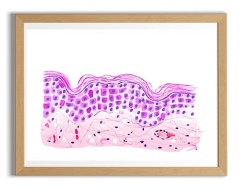 Haut Histologie Kunst, Dermatologen Geschenk, Dermatopathologie Druck, Pathologie Aquarell Kunstwerk