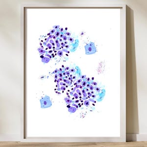Esophageal Tumor, Pathology Art, Oncology Art, Cytology Art, Pathologist Gift, Oncologist Gift, GI cancer, Oncology Art, Oncologist Gift