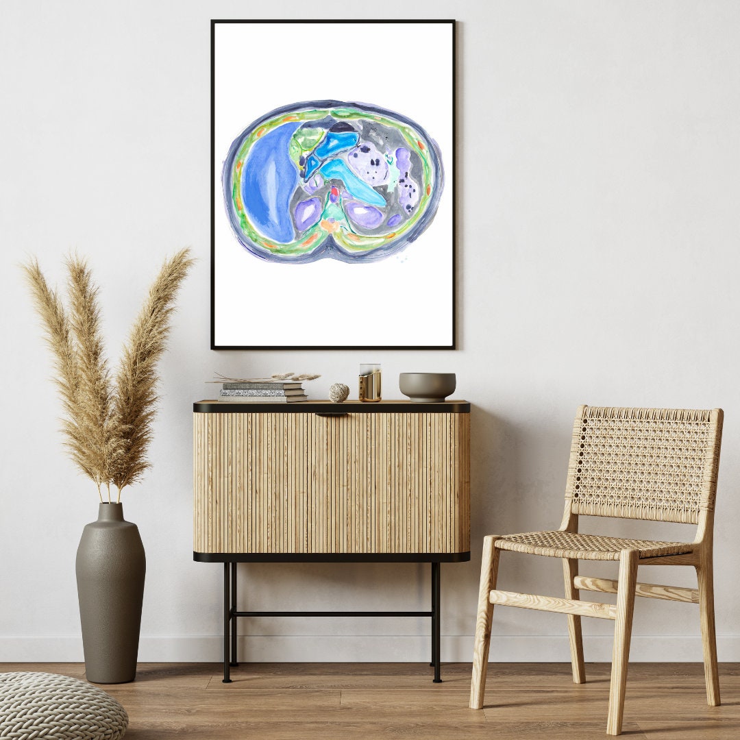 Radiology Artwork, CT Radiology, Abdominal Anatomy, Radiology Print ...