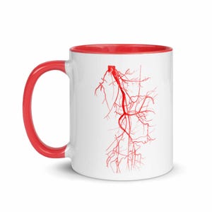Radiologimugg, present till kärlkirurgi, radiologmugg, present till kärlkirurg, present till kärlkirurgisk sjuksköterska, CT-angio-mugg