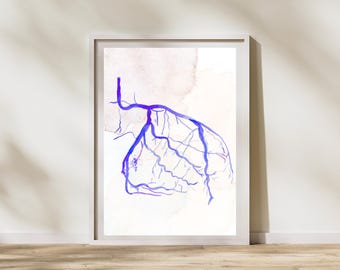 Coronary Angiogram Watercolor Art Print