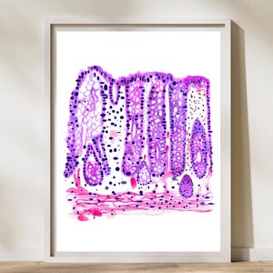 Colon Histology Art, Pathology Artwork, Endoscopy Biopsy Art, Gastroenterology and Endoscopy Doctor Nurse Physician Assistant Gift