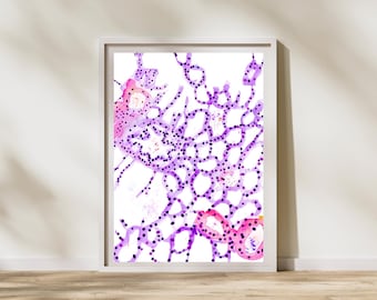 Lung Parenchyma Histology Watercolor Art Print, Pulmonology Medical Office Decor, Pathology Gifts