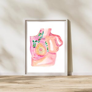 Op de afbeelding: Waterverfillustratie van een torso, wit omlijst. Het kunstwerk toont een roze en perzikkleurig lichaam met groene puntclusters, mogelijk lymfeknopen. De afbeelding staat tegen een witte muur en een houten vloer.
