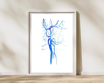 Carotid Artery Angiography Post Stenting, Interventional Radiology Neurosurgery and Vascular Surgery Watercolor Art Print