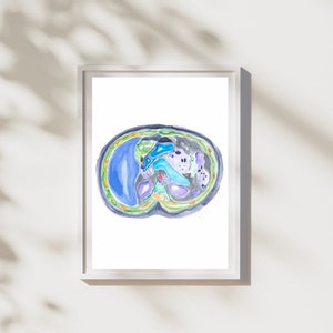 Radiology Artwork, CT Radiology, Abdominal Anatomy, Radiology Print ...