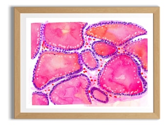 Graves Disease Thyroid Pathology Art – Endocrinology Office Wall Decor -  Gift for Endocrinologist Pathologist and Histology Technician