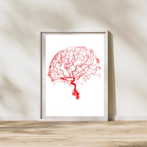 Cerebral Angiography Brain Arteries Art Print Neurosurgery Interventional Radiology Neurology Artwork