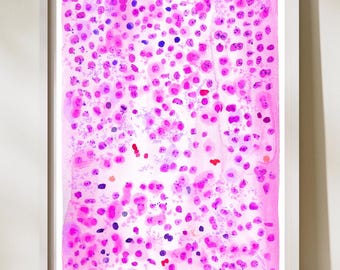 May include: Abstract watercolor painting in a white frame. The artwork features a pattern of pink and purple dots and blotches on a white background. Some dots are dark blue and red. The painting is a vertical rectangle.