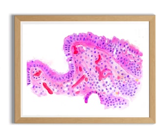 Pathologiekunst - Barretts-slokdarm, pathologiekunst, cadeau pathologie-assistent, gastro-enterologie kunst, geschenken endoscopie, histologie van de slokdarm