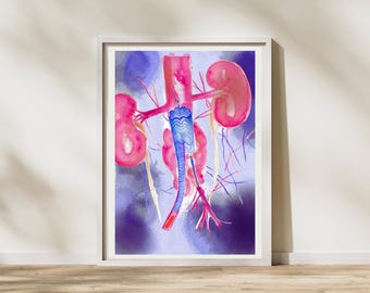 Stent Graft Abdominal Aorta Aneurysm, Interventional Radiology Art, Vascular Surgery Gifts, Radiology Decor