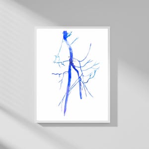 Femoral Artery Angiography, Vascular Surgeon Gift, Radiology Art, Radiology Poster, Radiologist Gift, Vascular Surgery, Vascular Doctor Gift