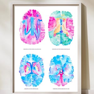 Könnte beinhalten: Ein gerahmter Druck mit vier Aquarellillustrationen von Gehirnquerschnitten. Jeder Abschnitt ist mit Text beschriftet und zeigt die Ebenen Corpus Callosum, Diencephalon, Stratum und Commissura ant. Das Kunstwerk verwendet eine lebendige Palette aus Rosa, Blau und Gelb.