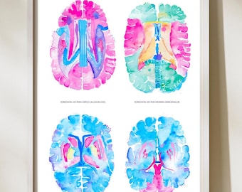 Brain Anatomy Art, Neuroscience Art, Neurology Art, Neurology Office Decor, Radiology Art, Neurologist Gift, Radiologist Gift