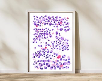 Multiple Myeloma, Hematology Oncology Art, Histopathology Art, Hematologist Gift, Pathologist Assistant Technician Resident Doctor Gift