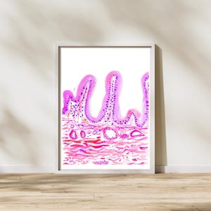 Cholecyst Histology, Histology, and Pathology Art, Gallbladder, Histology Tech Gift, Pathologist Assistant Gift