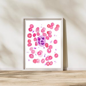 Megaloblastische Anämie, Hämatologie Kunst, Pathologie Kunst, Histotech Geschenk, Laborkunst, Hämatologie Geschenk, Pathologie Labor Geschenk