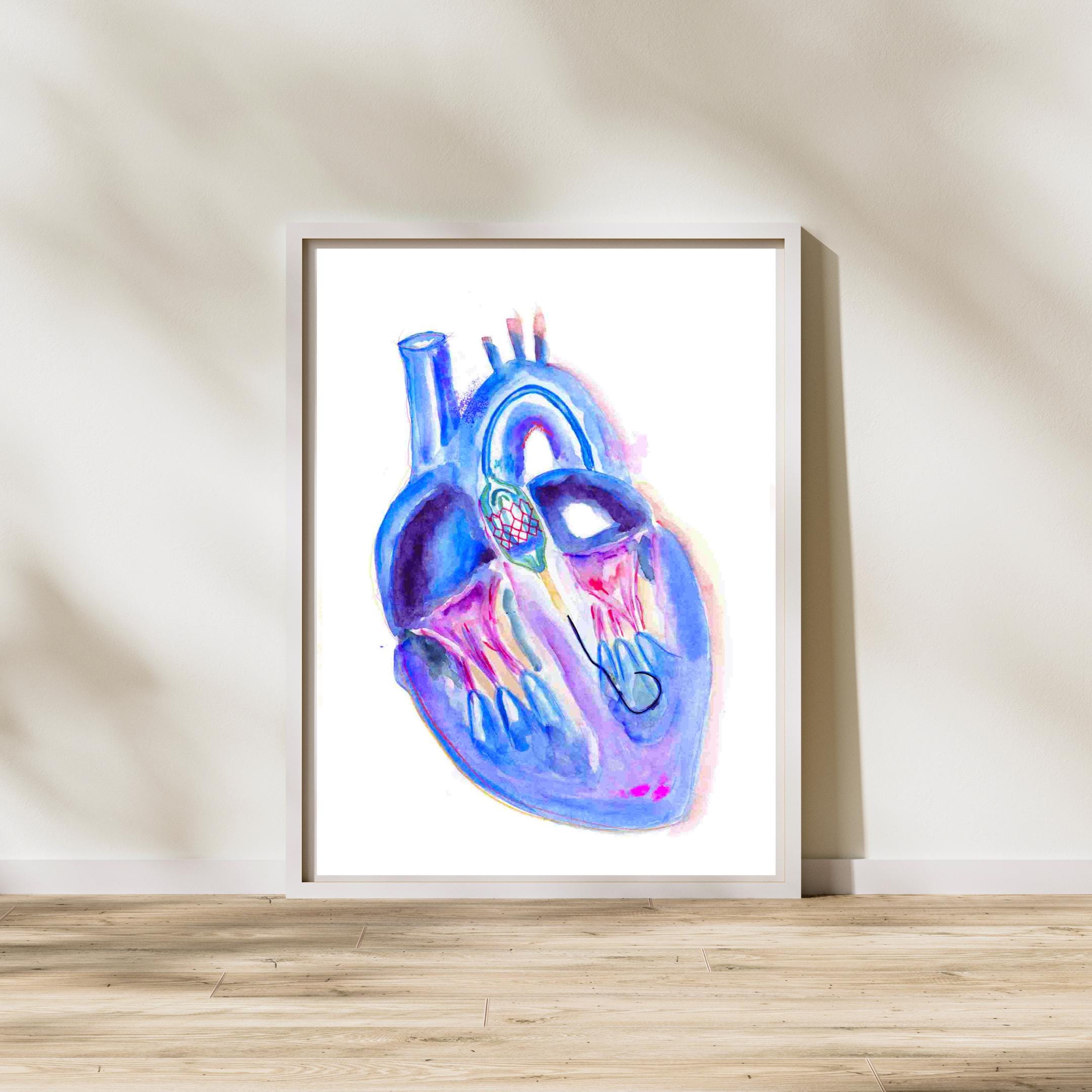 Transaortaklep vervanging, cardiologie kunst, cadeau interventie cardioloog, cadeau hartchirurg arts verpleegkundige, hart anatomie, Tav