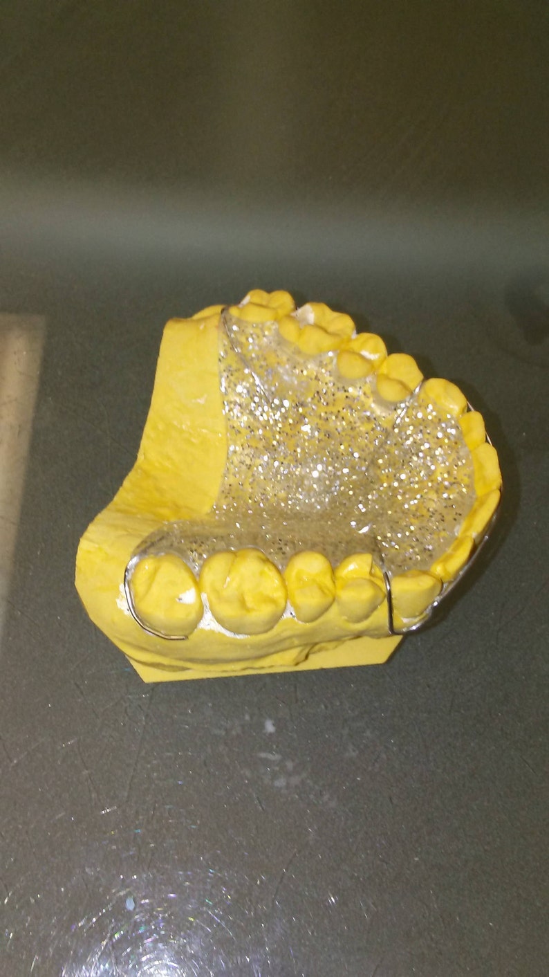 Orthodontic hawley retainer Etsy