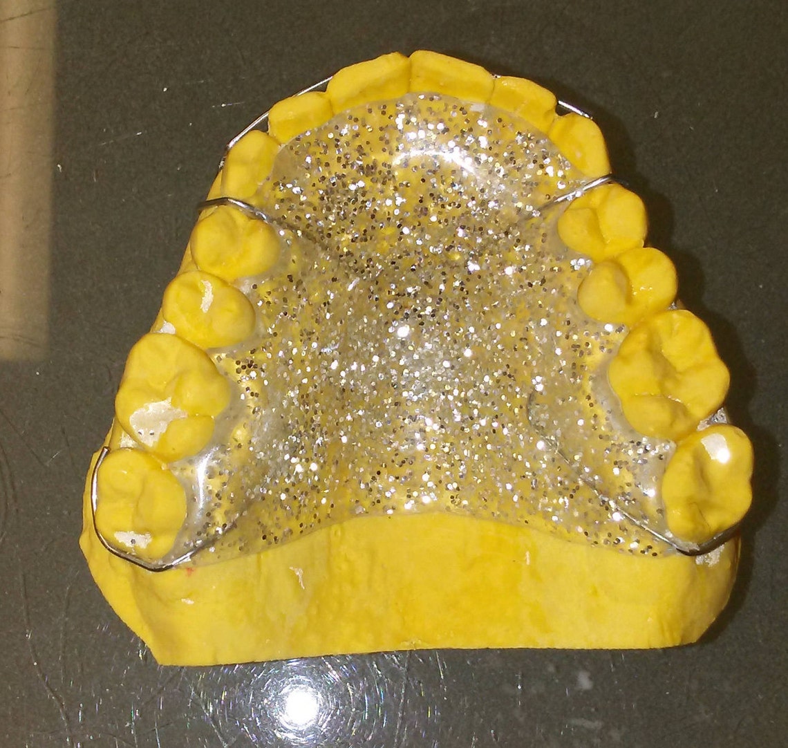 Orthodontic hawley retainer Etsy
