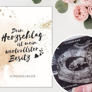 MAP ULTRASOON BEELD Glitter | Zwangerschap Geboorte Geheugenmap Zwangere Baby Baby Douche Anticipatie Moeder Opslag Cadeau