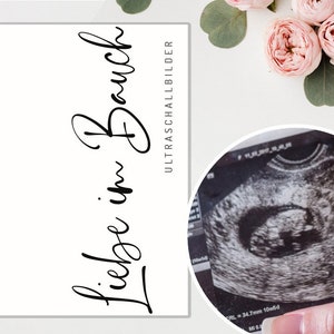 MAP ULTRASONE AFBEELDINGEN Zwart en Wit | Zwangerschap Geboorte Geheugenmap Zwangere baby Babyshower Anticipatie Moederopslag
