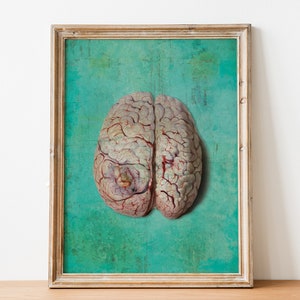 Vintage Victorian Pathology Medical Diseased Brain Print Giclee Anatomy Print on Cotton Canvas and Paper Canvas Home Wall Decor