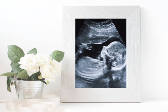 18+ Finest Sonogram wall art images information