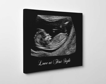 Sonogram canvas art, best selling items baby, expecting mom gift, ultrasound canvas, mother to be gift, expecting parents,